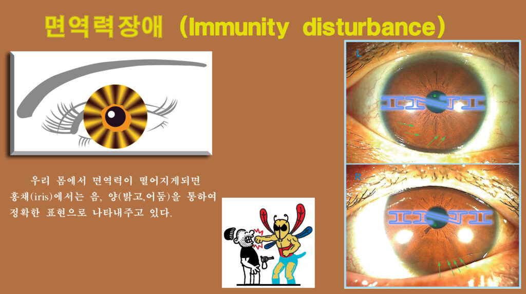 d874 좌 26면역력장애 복사
