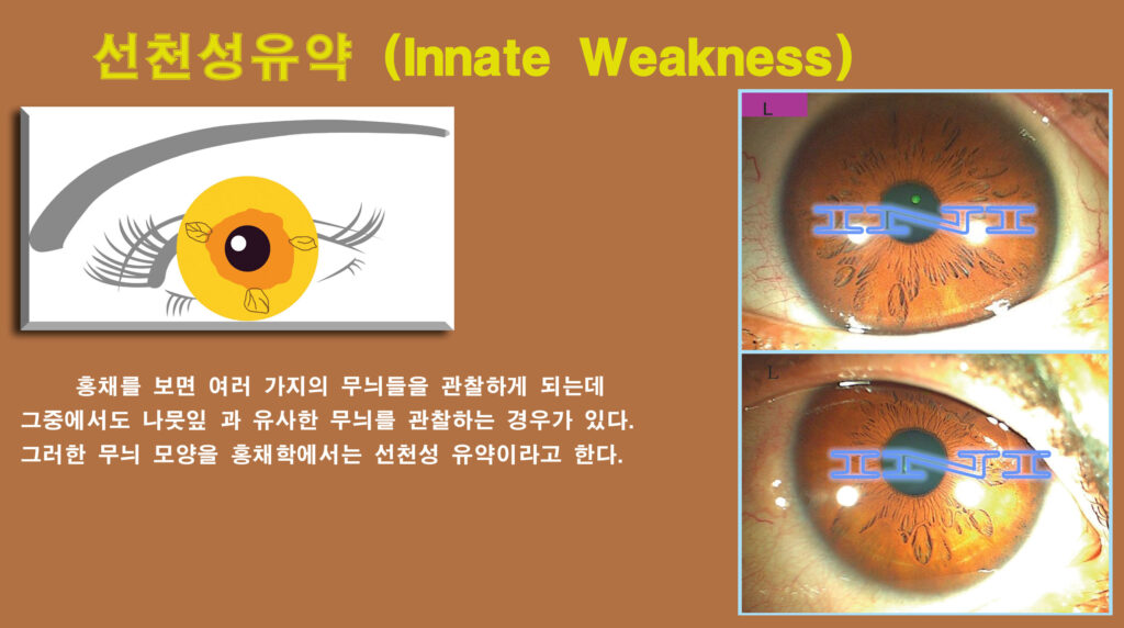 d874 좌 29선천성유약 복사