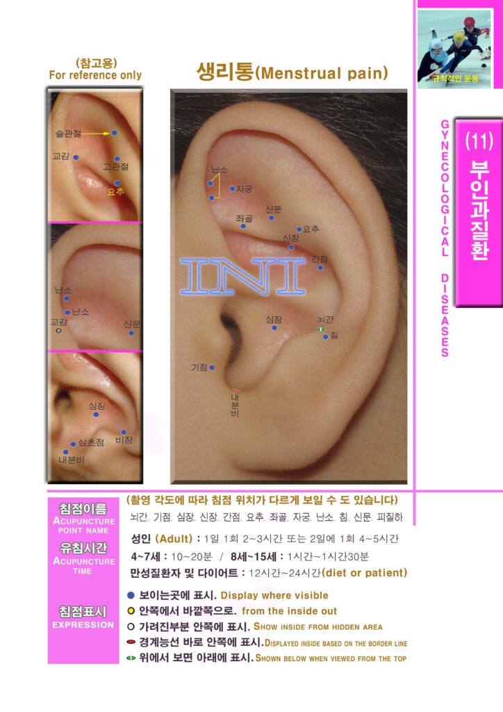 생활 이침요법 | Practical Auriculotherapy 이침1 1mk104 부인과1 생리통 우 복사 사본