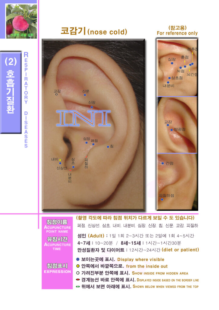 생활 이침요법 | Practical Auriculotherapy 이침2 1mk49 호흡기질환5 코감기 좌 복사 사본