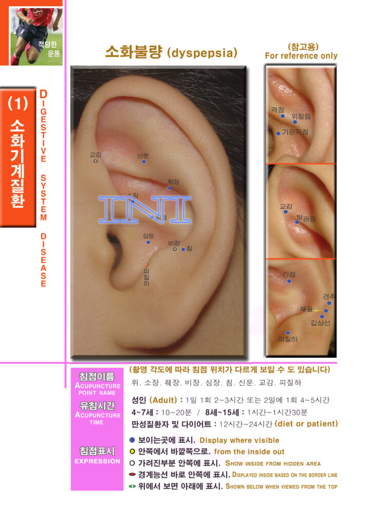생활 이침요법 | Practical Auriculotherapy 이침4 1mk41 소화기계질환1 소화불량 좌 복사 사본