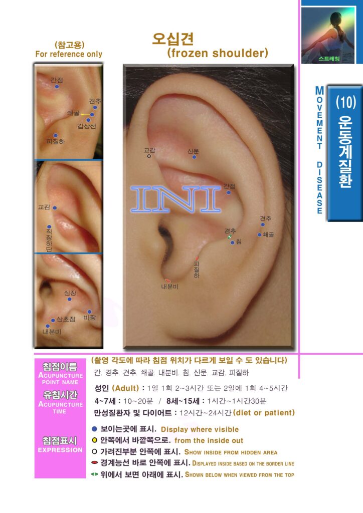 생활 이침요법 | Practical Auriculotherapy 이침6 1mk110 기타3 ㅇ오십견 복사