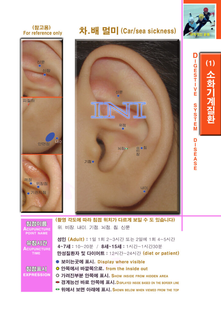 생활 이침요법 | Practical Auriculotherapy 이침7 1mk42 소화기계질환2 차 배멀미 우 복사 사본